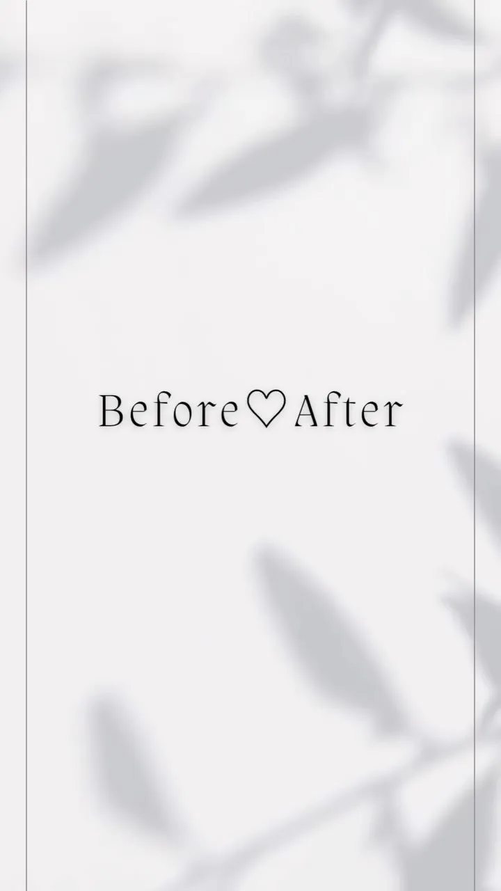 プラズマネオ照射後　ニキビ治療ビフォーアフター